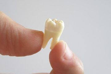 Extractions
