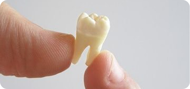 Extractions