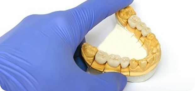 Fillings & Crowns